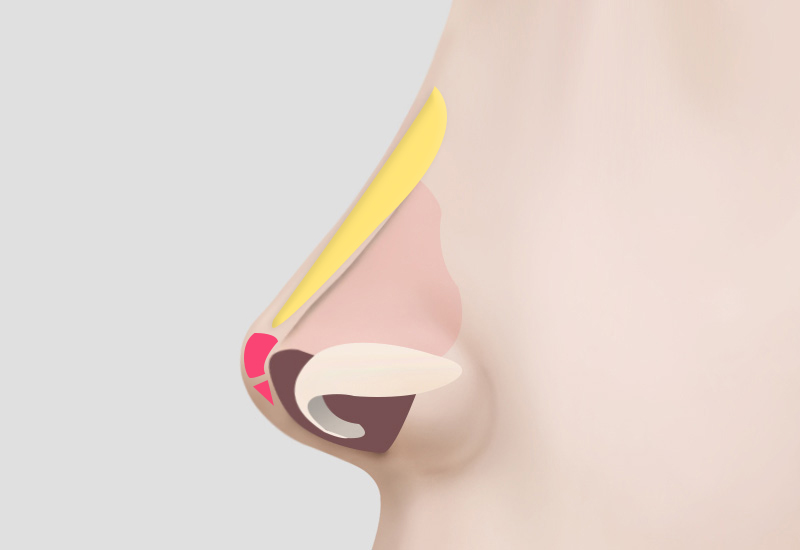 缝合与形态矫正