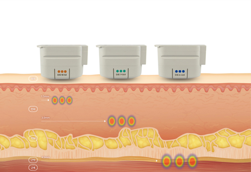 个性化深度设计